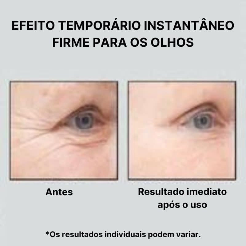 (🎁Última Semana Com Desconto🎁) - Creme Restaurador de Idade com Efeito Imediato