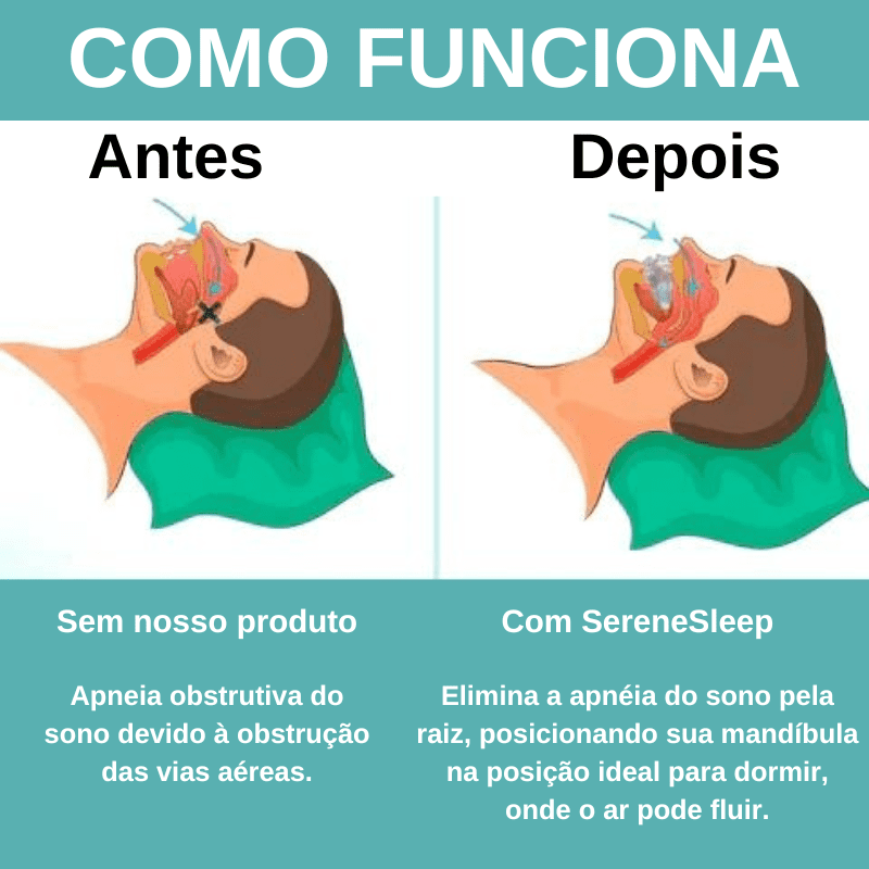 SereneSleep Antirronco adaptável a qualquer mandíbula