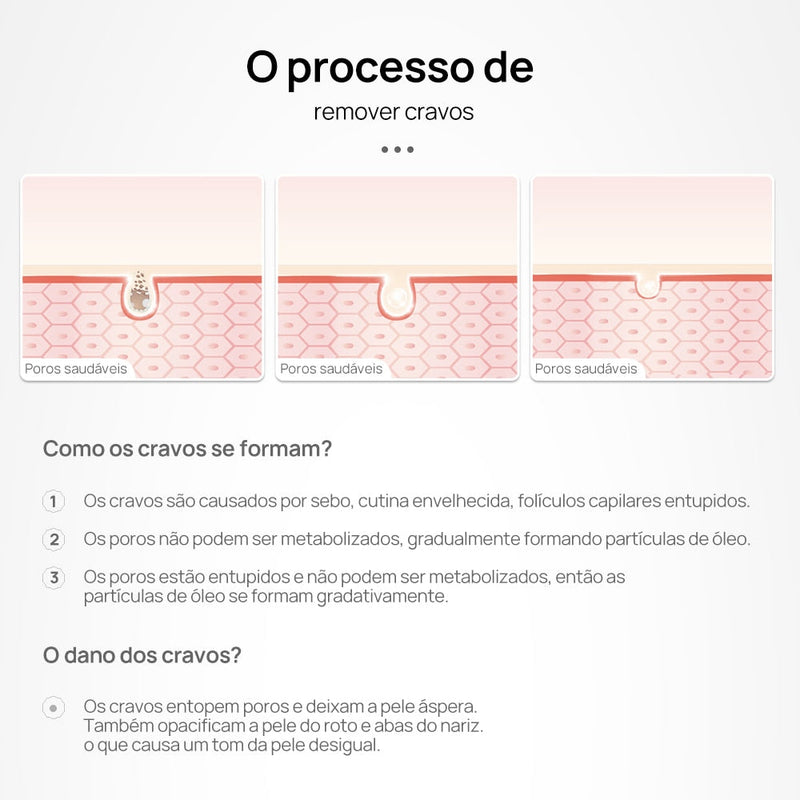 LANBENA Rosto Removedor de Cravos